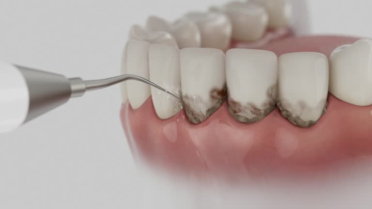 Trusted Root Canal Treatment service in St. Pauls, NC - Dentist Open Now